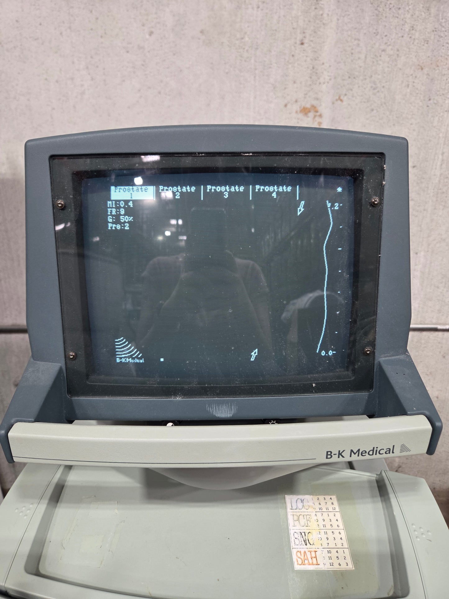Falcon Ultrasound Scanner, Used
