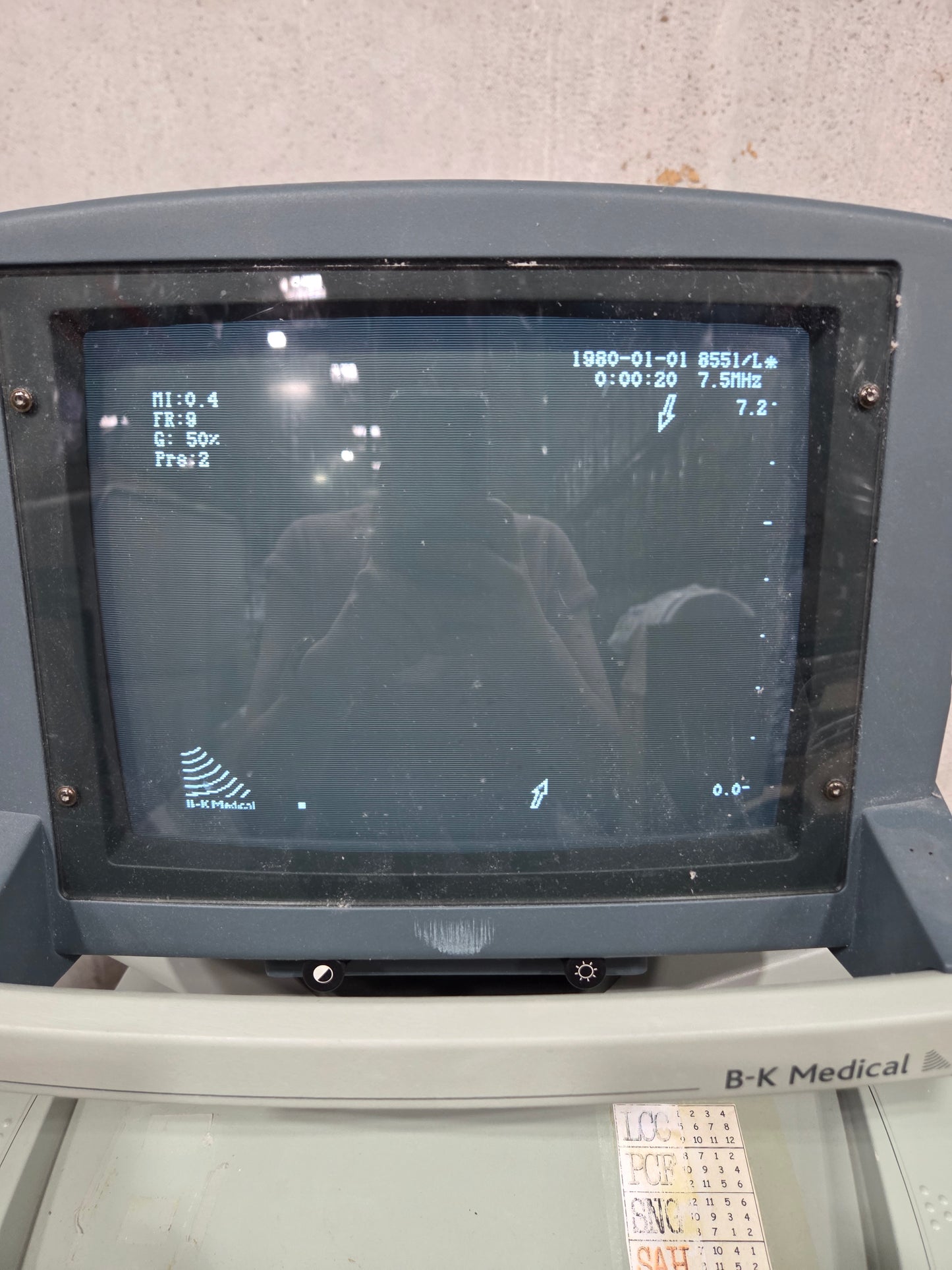 Falcon Ultrasound Scanner, Used