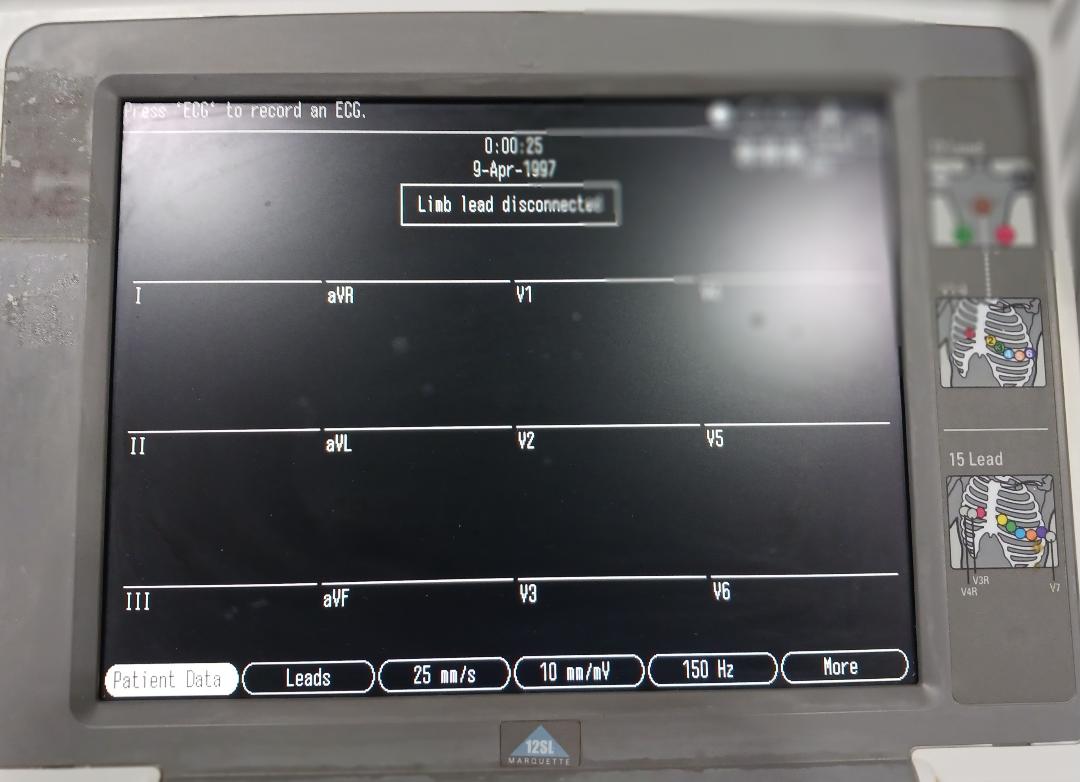 MAC5500 ECG Analysis System on Rolling Cart, Used/Tested - 1724026